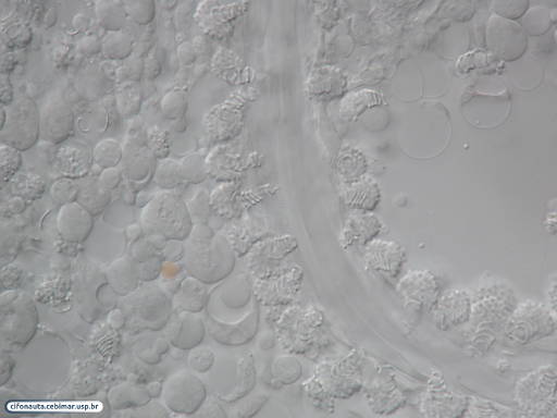 Comb jelly (ctenophore) adhesive cells (coloblasts)