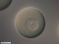 Ovule before the formation of the second polar body
