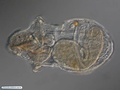 Pelagosphaera larva