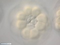Micromeres in a 32 cell embryo