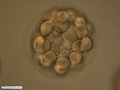 Embryo during sixth cleavage