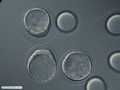 Blastula and unfertilized eggs