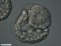 Malformed embryo