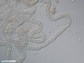 Comb jelly (ctenophore) adhesive cells (coloblasts)