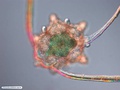 Brittle star larva