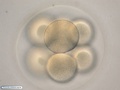 Embryo with 8 cells