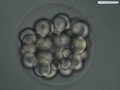 Embryo with 32 cells