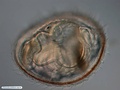 Bryozoan larva (cyphonautes)