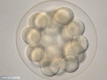 Embryo with 32 cells