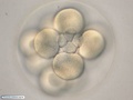 Embryo with 16 cells