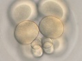 Embryo during fourth cleavage
