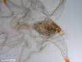 Larva de estrela-do-mar (bipinária)