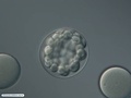 Embryo during sixth cleavage