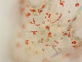 Larva plúteos de bolacha-do-mar