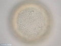 Células ectodérmicas durante formação da blástula em uma bolacha-do-mar