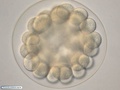 Embrião de bolacha-do-mar com 56 células