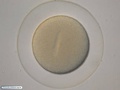 Embrião de bolacha-do-mar com 1 célula