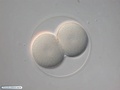 Four-cell stage embryo