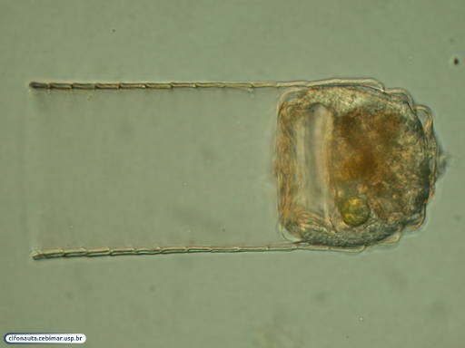 Tintinnid with hyaline lorica