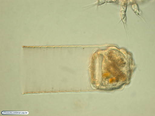 Tintinnid with hyaline lorica